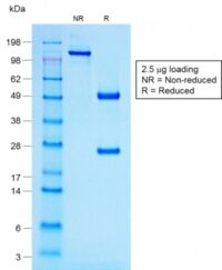 Data from SDS-PAGE analysis of Anti-ACTH antibody (Clone r57). Reducing lane (R) shows heavy and light chain fragments. NR lane shows intact antibody with expected MW of approximately 150 kDa. The data are consistent with a high purity, intact mAb.